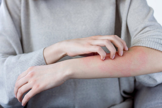 Kann Weizengrassaft bei der Heilung von Dermatitis helfen? - Britt's Superfoods DE